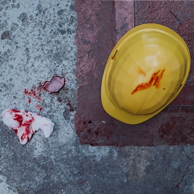 skitterblink industrial accident